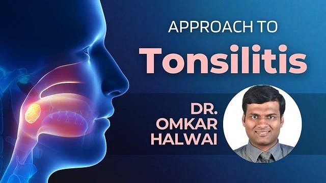 Approach to Tonsilitis