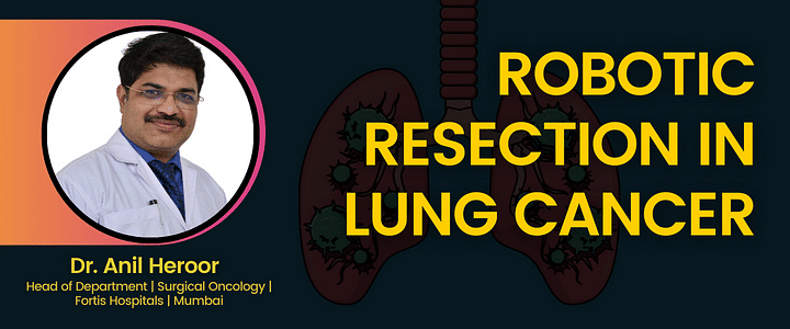Robotic Resection in Lung Cancer