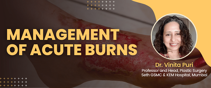 Management of Acute Burns