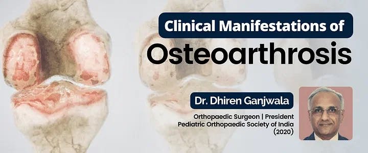 Clinical Manifestations of Osteoarthrosis