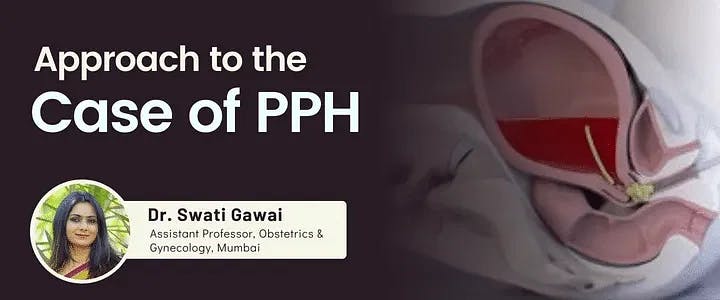 Approach to the Case of PPH